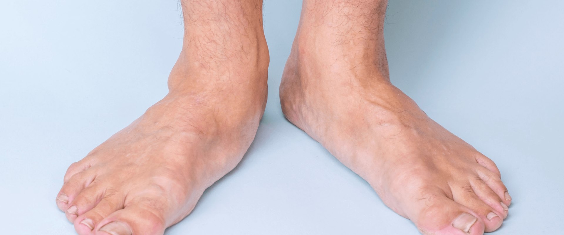 Fixing Foot Deformities: Non-Surgical and Surgical Options