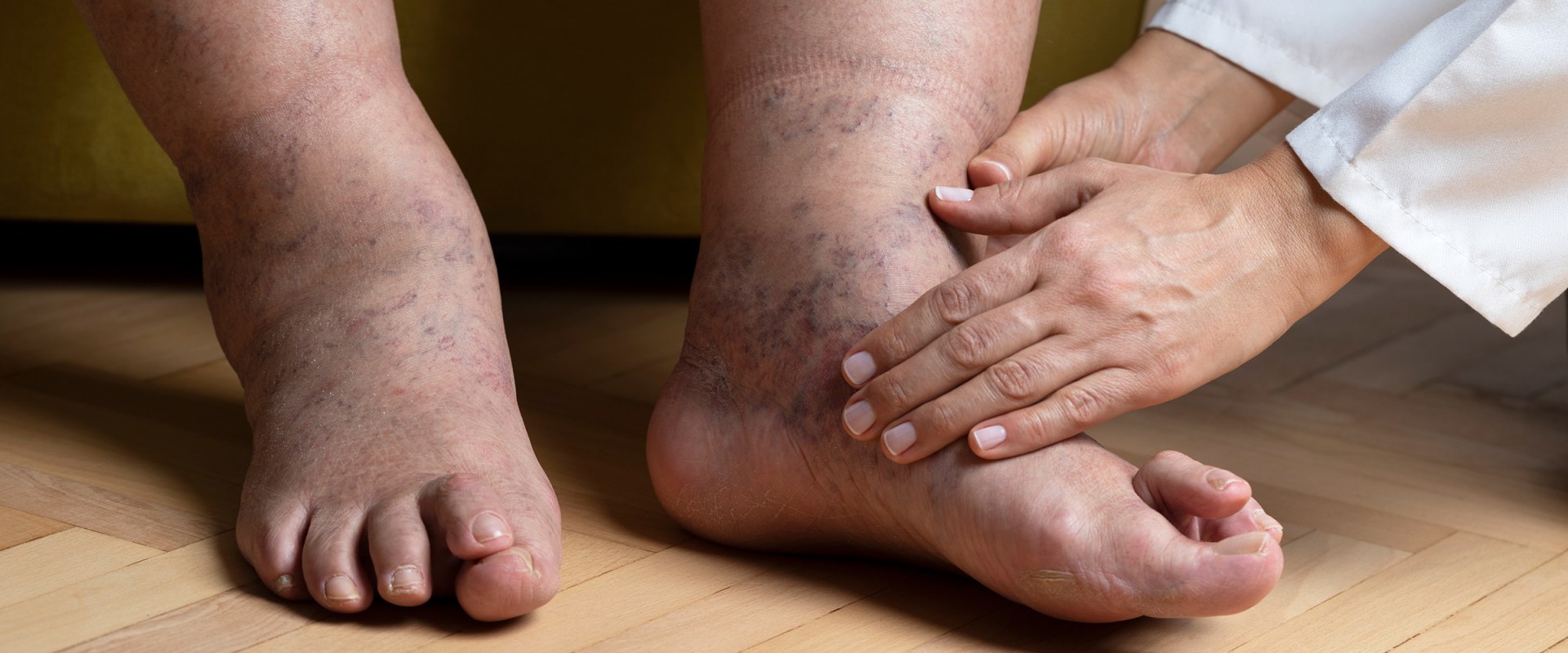 Expert Insights: Understanding the Most Common Foot Problems in Older Adults