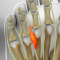 Expert Tips for Managing Foot Pain