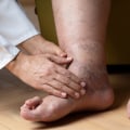 Expert Insights: Understanding the Most Common Foot Problems in Older Adults