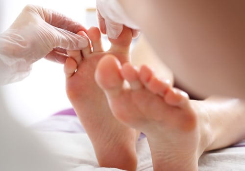 Understanding Diabetic Toenails: What They Look Like and When to Seek Help for Foot Disorders