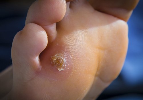 Unusual Foot Problems: What You Need to Know