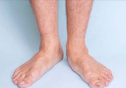 Fixing Foot Deformities: Non-Surgical and Surgical Options