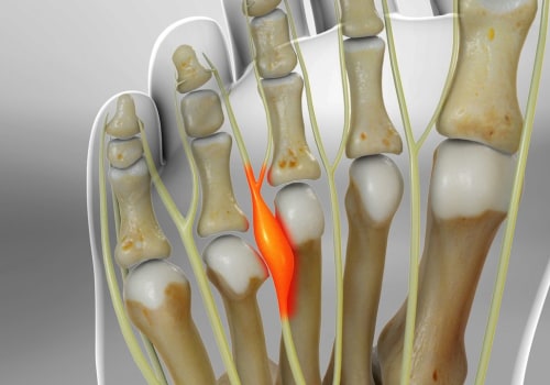 Expert Tips for Managing Foot Pain