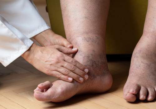 Expert Insights: Understanding the Most Common Foot Problems in Older Adults