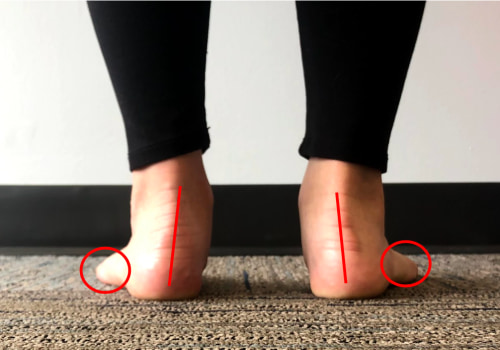 Understanding Foot Posture: An Expert's Perspective